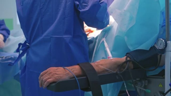 手术过程中患者的手用管子和带子。手术过程与一群医生在手术室。特写。