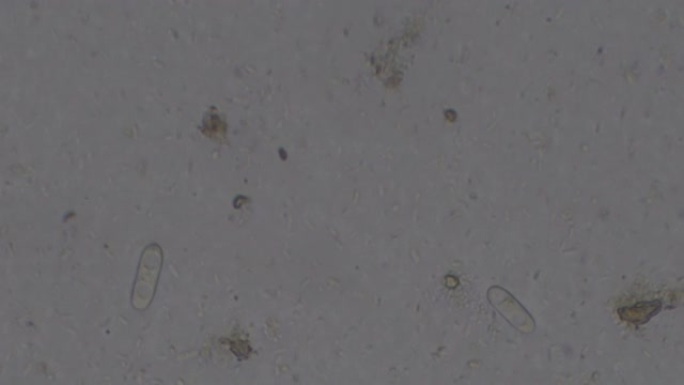 兔粪便中球虫生物的显微镜检查。卵囊形式的寄生虫 (Eimeria物种)。这些生物生活在兔肠中，可以感