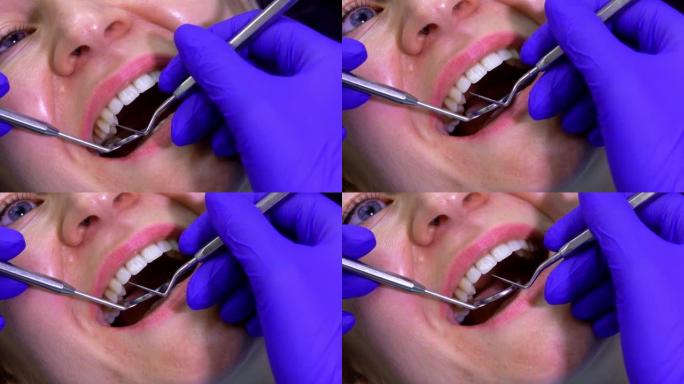 牙医在口腔中进行专业牙齿清洁的特写镜头