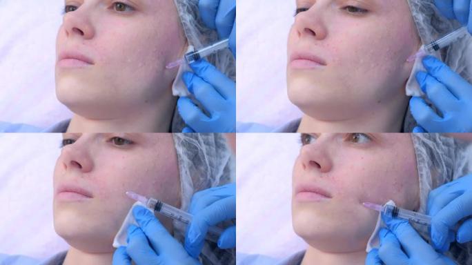 美容师在女性面部皮肤中进行多次注射生物evitalization。