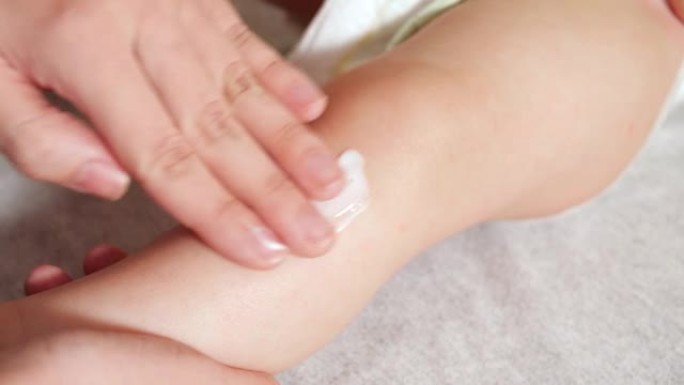 妈妈在小男孩的腿上擦婴儿粉刺药膏
