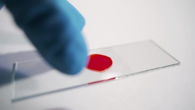 女实验室技术人员在实验室的移液器中以慢动作在载玻片上滴血，双手戴着乳胶手套特写。