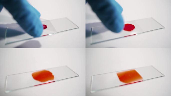 女实验室技术人员在实验室的移液器中以慢动作在载玻片上滴血，双手戴着乳胶手套特写。