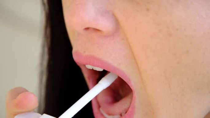 咽喉痛喷雾。用喷雾剂治疗喉咙并将其洒在嘴里的女人。健康和疾病的概念。
