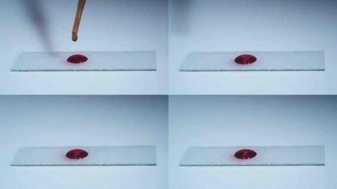 实验室技术人员拿着移液器，在医院病房中测试血液样本是否输血，双手合十。