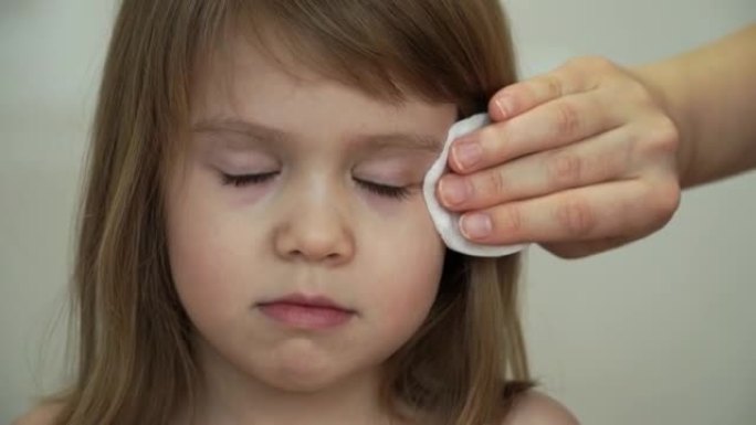 母亲的双手将无菌的棉球消毒剂涂在小女孩的眼睛上。儿童损伤治疗的特写。健康和护理概念