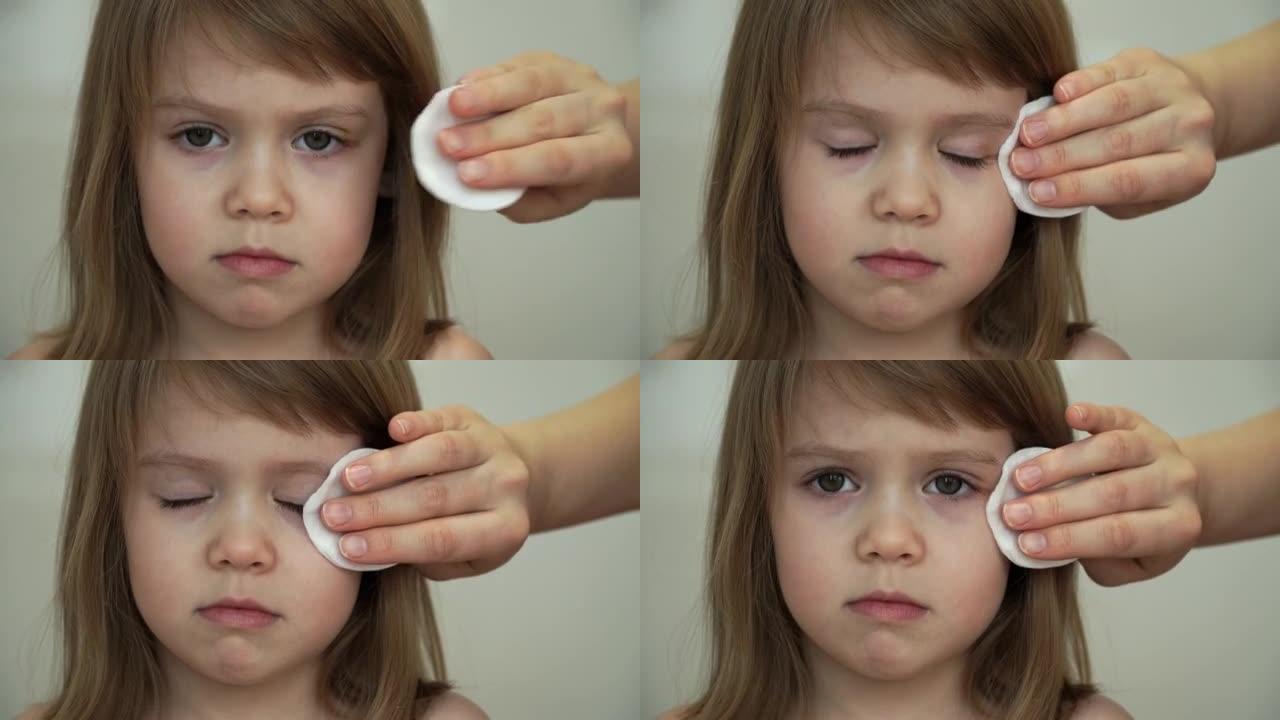 母亲的双手将无菌的棉球消毒剂涂在小女孩的眼睛上。儿童损伤治疗的特写。健康和护理概念