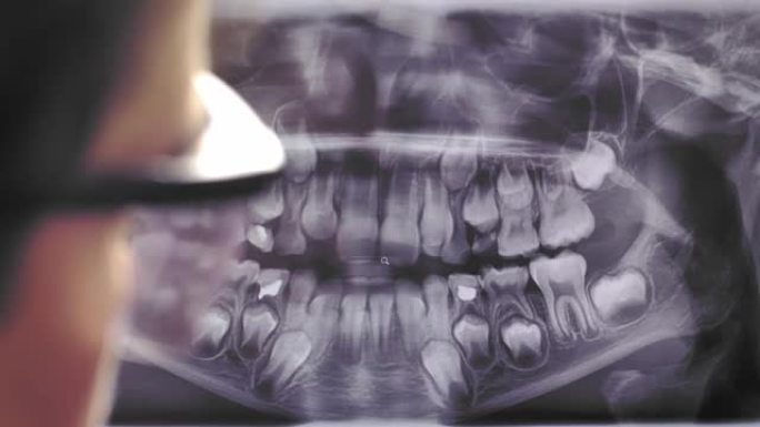 女性牙医在防护眼镜中检查的全景牙科x射线图像