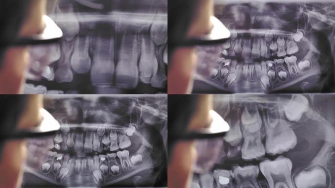 女性牙医在防护眼镜中检查的全景牙科x射线图像