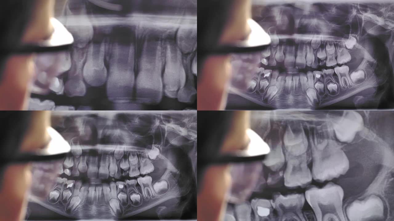 女性牙医在防护眼镜中检查的全景牙科x射线图像