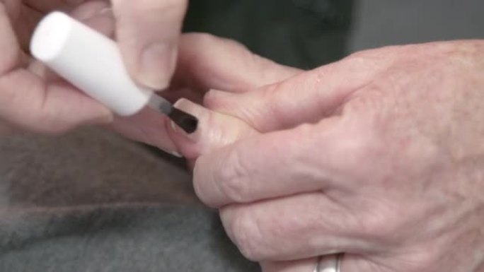 特写镜头，一名老年高加索妇女在家中由专业护理人员修指甲