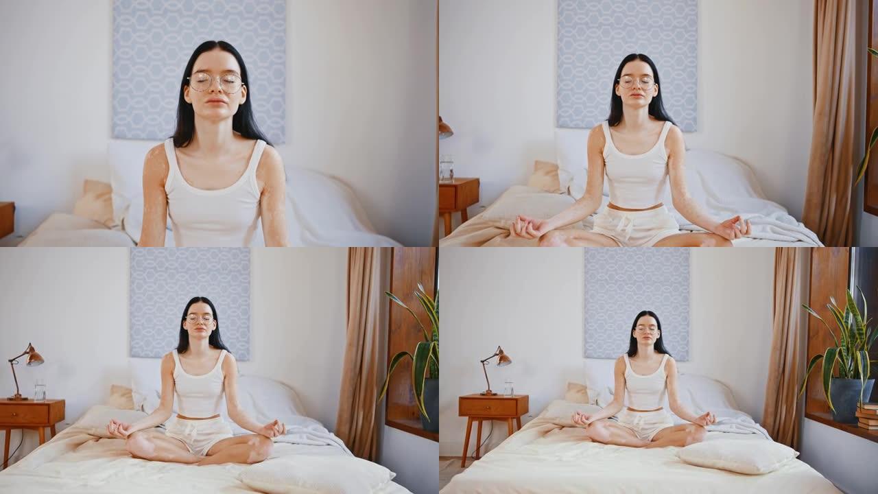 早晨瑜伽练习。少妇白癜风皮肤在家冥想，坐在床上，缩小