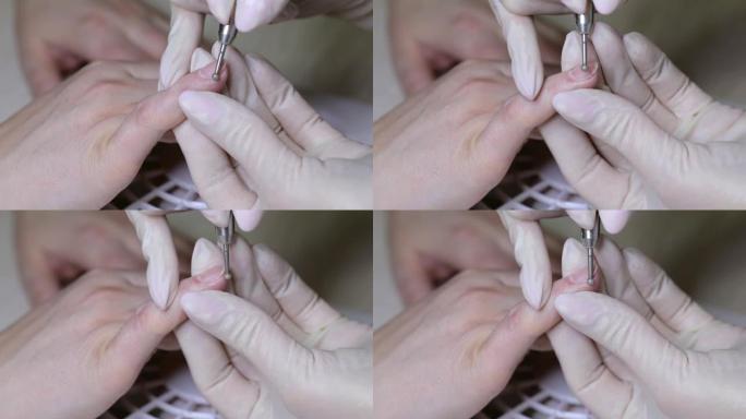 用圆形工具处理指甲的粗糙角质层和横向褶皱。