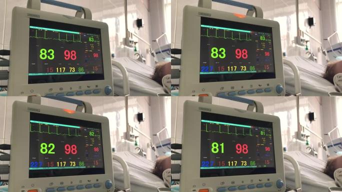 心血管内科ICU监护仪在医院接受患者生命体征检查