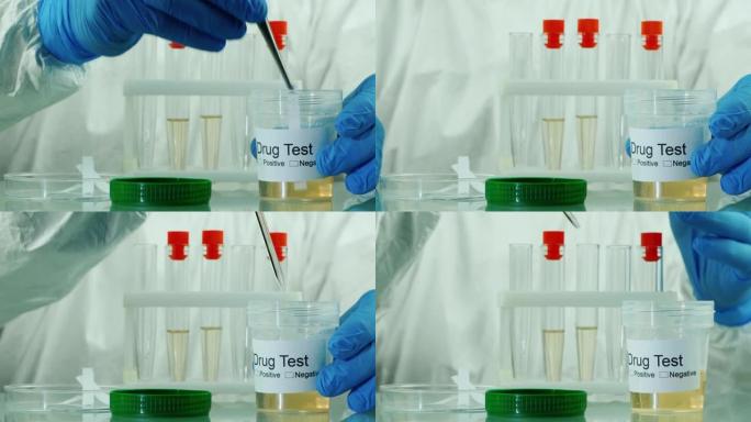 实验室技术员的手做尿检兴奋剂或药物含量