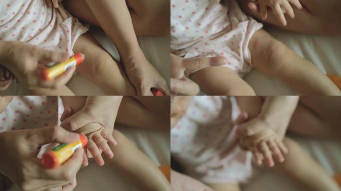 亚洲母亲在蚊子叮咬的皮肤婴儿上使用了过敏药。
