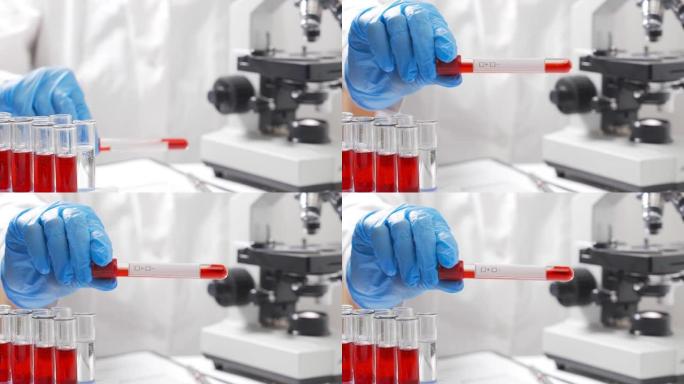 实验室助理对血液涂片进行微生物学分析。概念-血液系统疾病，血液癌症