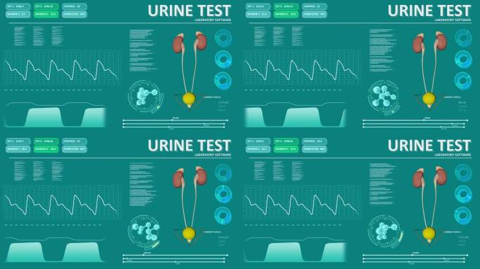 医疗设备的抽象屏幕-尿液测试，无缝循环