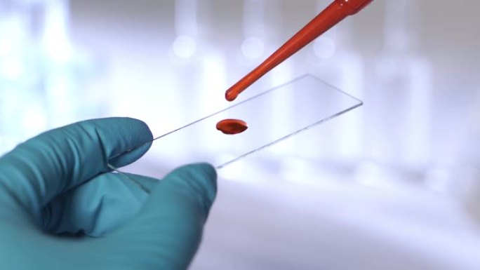 实验室技术员拿着移液器并在医院病房中测试血液样本是否输血，双手合拢