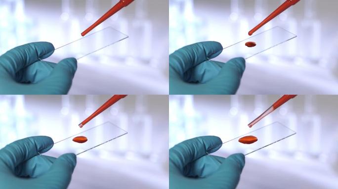实验室技术员拿着移液器并在医院病房中测试血液样本是否输血，双手合拢