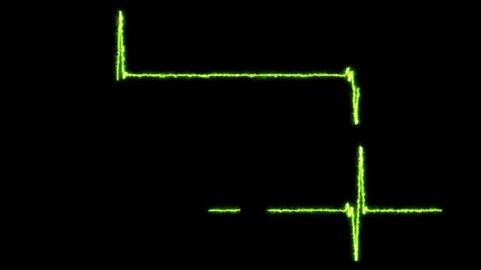 能量心跳平行线。无缝循环动画。EKG心率显示屏医学研究脉冲跟踪绿线。运动动画