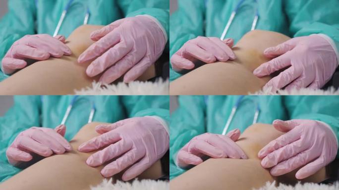 医生戴着医用手套的手的特写镜头，检查一名女性患者受伤的膝盖。