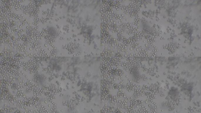酵母细胞显微镜 (酿酒酵母)。颗粒细胞运动的单色背景。