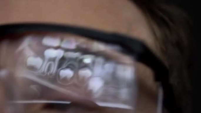 牙医分析防护眼镜中反射的全景牙科x射线图像
