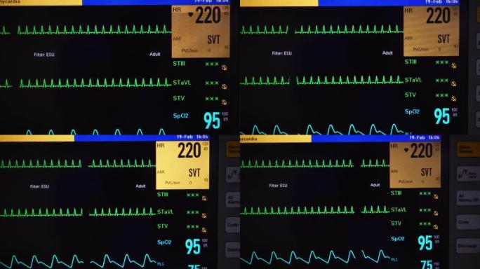 生命体征监护仪心电图心率医疗医院仪器