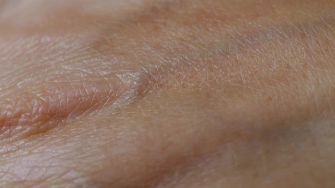 真正干燥的老年皮肤的宏观拍摄。夏季晒伤时，手部人体皮肤上的皱纹会闭合皮肤纹理。雀斑色素沉着静脉过敏。