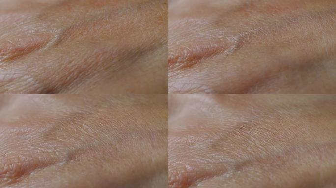 真正干燥的老年皮肤的宏观拍摄。夏季晒伤时，手部人体皮肤上的皱纹会闭合皮肤纹理。雀斑色素沉着静脉过敏。