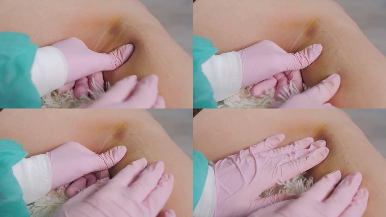 戴着医用手套的医生会感觉到女性患者膝盖的内部，试图确定损坏程度。