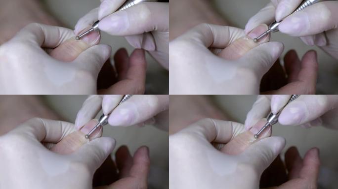 用圆形工具处理指甲的粗糙角质层和横向褶皱。