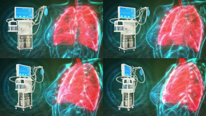 cg医学3D动画，肺和ICU肺呼吸机