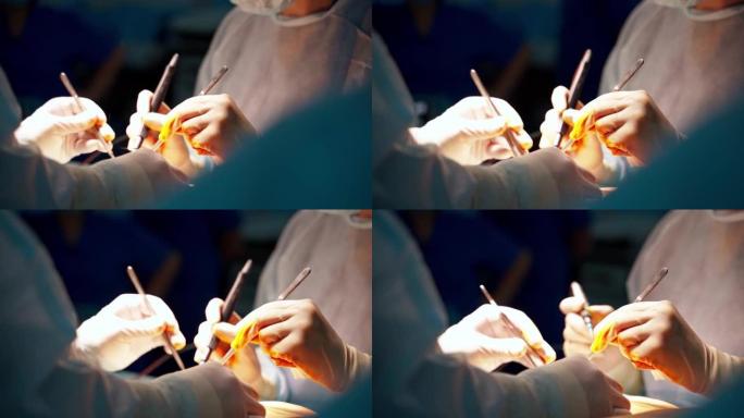 外科手术腹部整形术。手术台上病人的特写。手术切除腹部脂肪组织