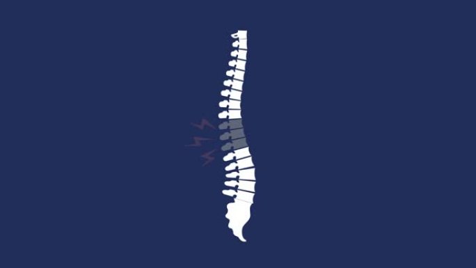 重点关注脊椎区域。背部疼痛动画插图与脊柱