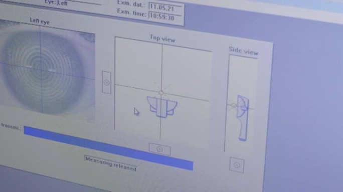 眼科诊所检查过程中数字生物识别和眼睛断层扫描的屏幕视图结果
