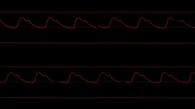 血压波跳动弹跳线条