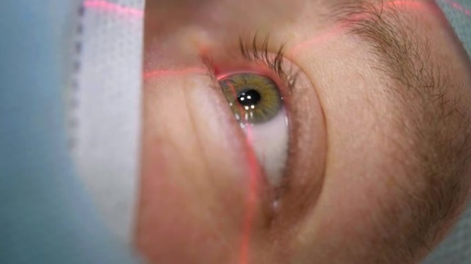 激光视力矫正。在手术室进行眼科手术之前，患者的眼睛躺在手术台上的特写视图。