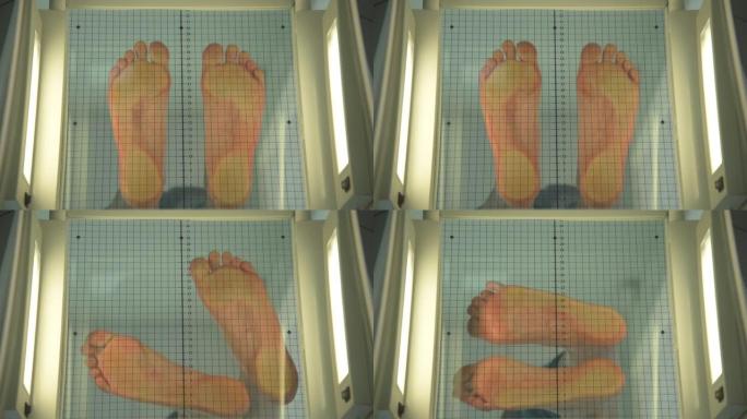 病人站在一个特殊的仪器上，用于确定扁平足。骨科医生评估脚的负荷分布。扁平脚类型的测定。扁平足程度的测