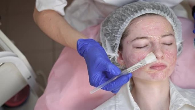 皮肤的水化和痤疮治疗。年轻的女性美容师在医用手套用刷子将凝胶面膜涂在年轻少女的脸上。护肤，面部护理，