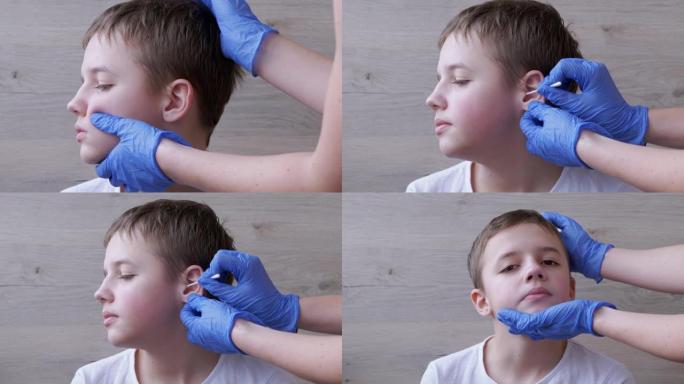 耳鼻喉科医生用棉签清洁孩子的耳朵，耳道