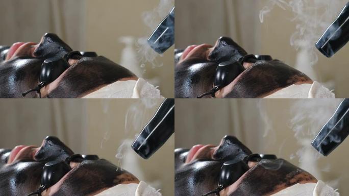 美容师制作碳面部剥离程序。激光脉冲清洁面部皮肤。硬件美容治疗。激光剥离的过程。面部皮肤嫩肤。4 k视