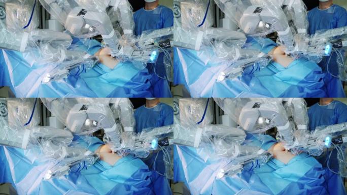 达芬奇系统手术。医院先进的机器人手术机器
