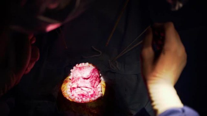 神经外科手术期间患者的内脏器官。医生在黑暗背景下的手术中使用手术工具。手术过程中的光点。Close-