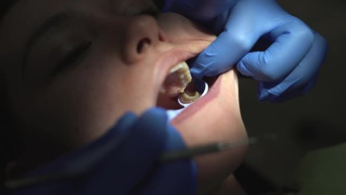 牙医的女士嘴的特写镜头用牙科灯照亮。牙医椅上张开嘴的女性病人脸。牙科诊所的专业牙科修复。高质量4k拍