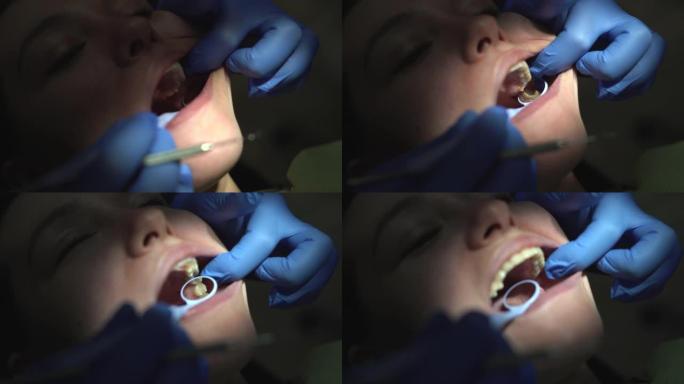 牙医的女士嘴的特写镜头用牙科灯照亮。牙医椅上张开嘴的女性病人脸。牙科诊所的专业牙科修复。高质量4k拍