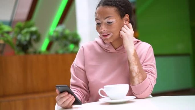 患有白癜风色素沉着皮肤问题的黑人非洲裔美国妇女室内穿着粉色连帽衫在智能手机上通过视频聊天