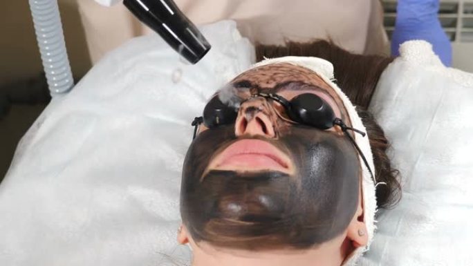 美容师制作碳面部剥离程序。激光脉冲清洁面部皮肤。硬件美容治疗。光热解、温热皮肤、激光脱皮过程。面部皮