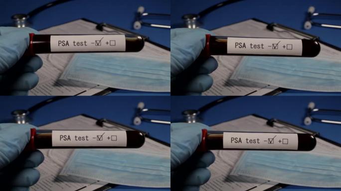 血液检测PSA。带血的真空管。